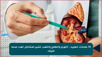 10 علامات خطيرة.. التورم والطفح والتعب تشير لمشاكل تهدد صحة كليتك